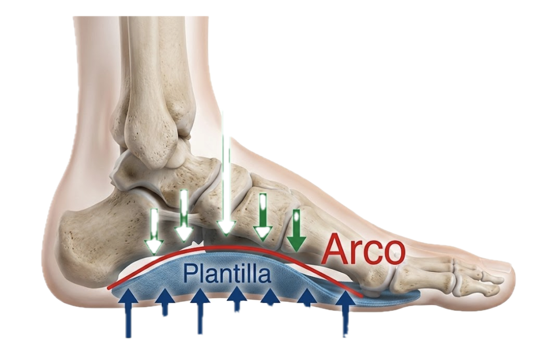 Plantilla ortopédica que sostiene el arco de forma pasiva