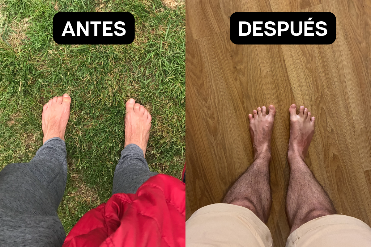 Pies de Ignacio después del Método RootFoot — arco visible y dedos separados