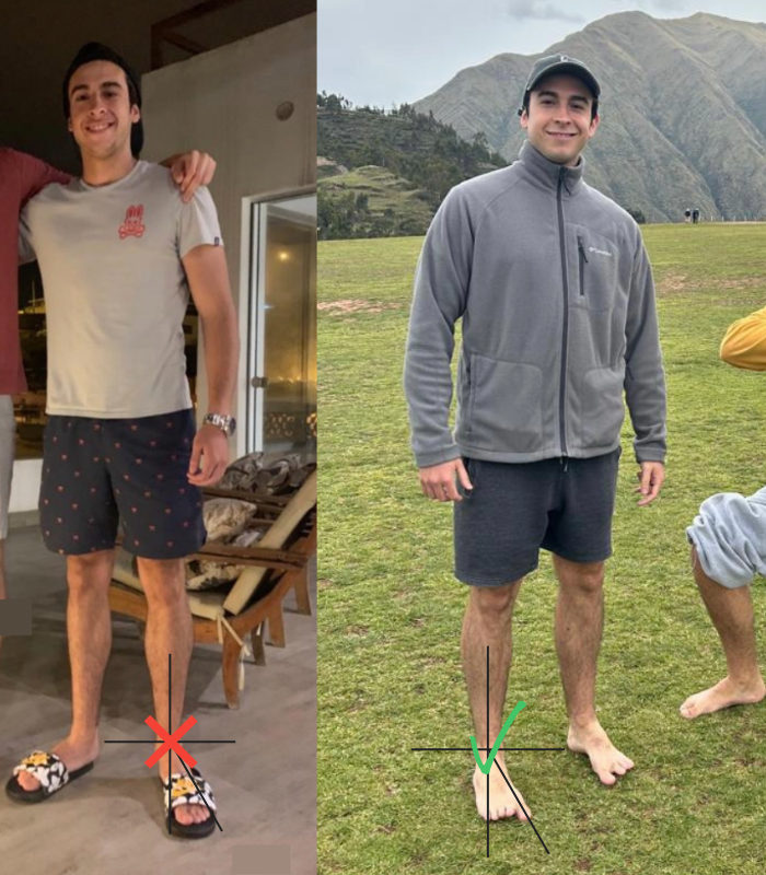 Antes y después de la pisada de Ignacio